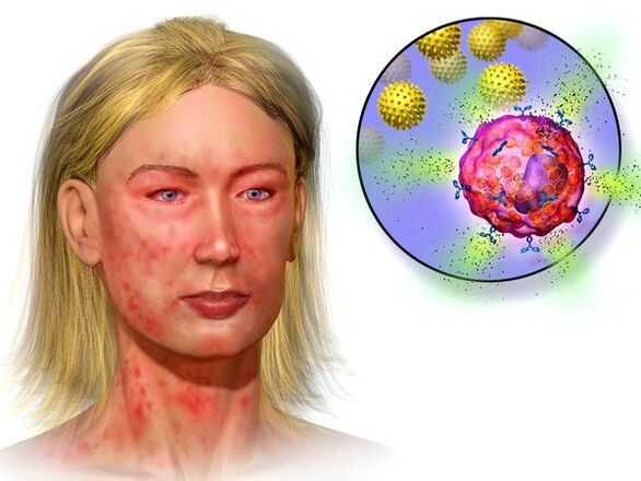 echinokokken en symptomen van hun aanwezigheid in het lichaam