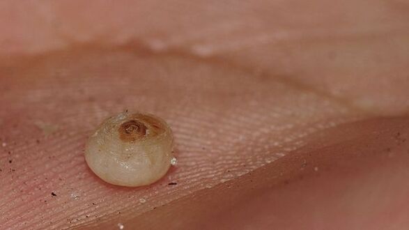 sarcopsillose met onderhuidse parasieten
